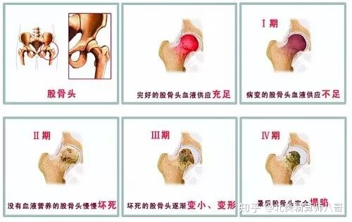 巴彦保健。糖尿病患者可以做供卵试管婴儿帮助他们受孕吗？