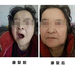 5次供卵做试管移植失败,孕育医生吊针醋酸阿托西班能提升着床吗