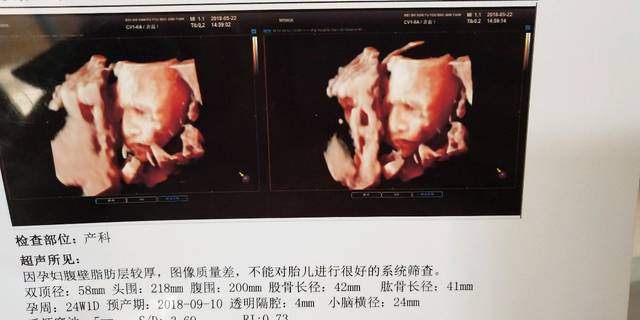 提高精子质量最佳方法