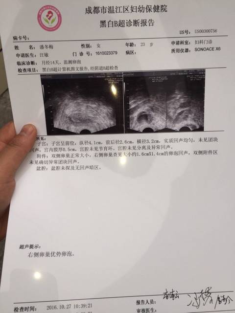 张纪中老婆借卵试管