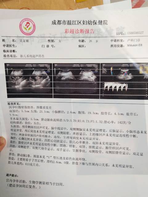 张纪中老婆借卵试管