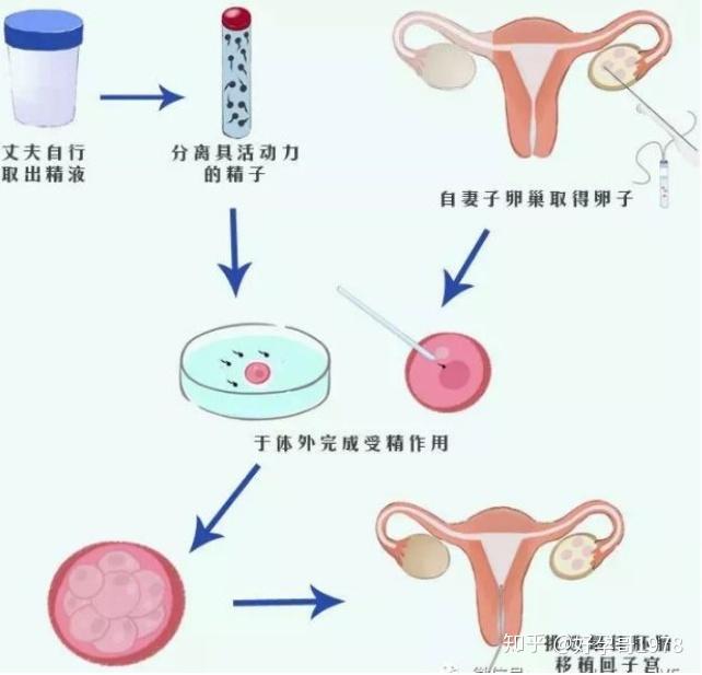 做赠卵试管排卵针什么时候打最佳