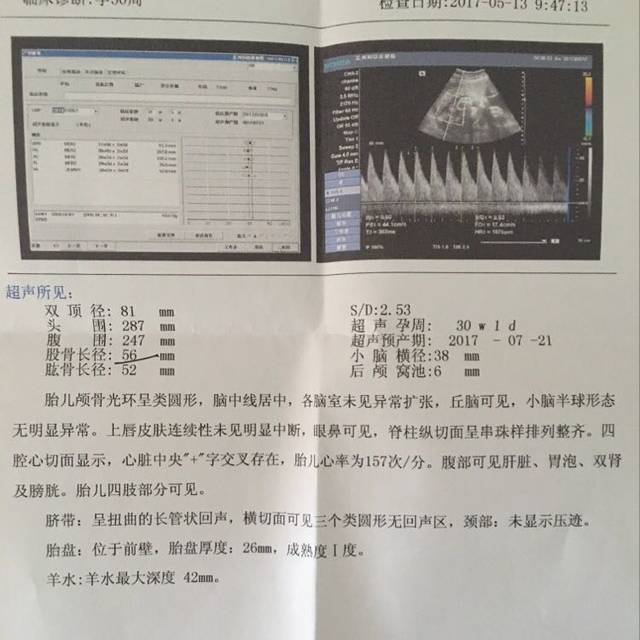 孕宝国际助孕_无精症可以哪里能找到试管代怀吗？两种情况的治疗方式不一样